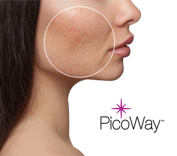 Picoway resolve