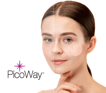 Picoway laser 